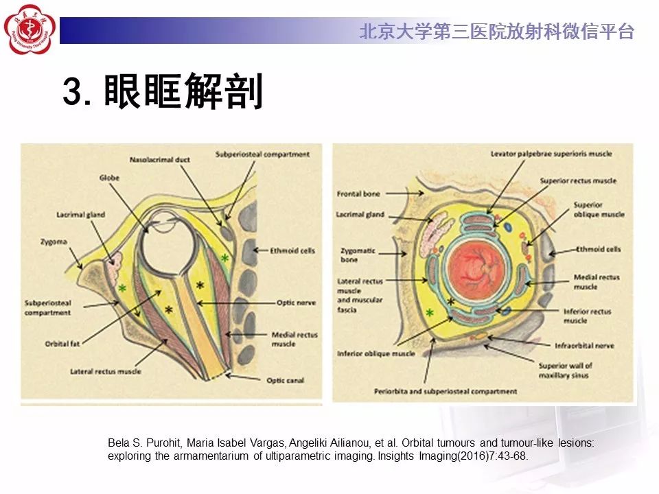 【病例】眼眶淋巴瘤1例CT影像表现