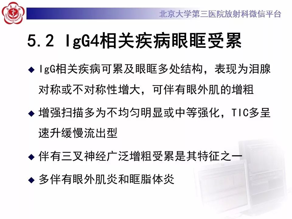 【病例】眼眶淋巴瘤1例CT影像表现