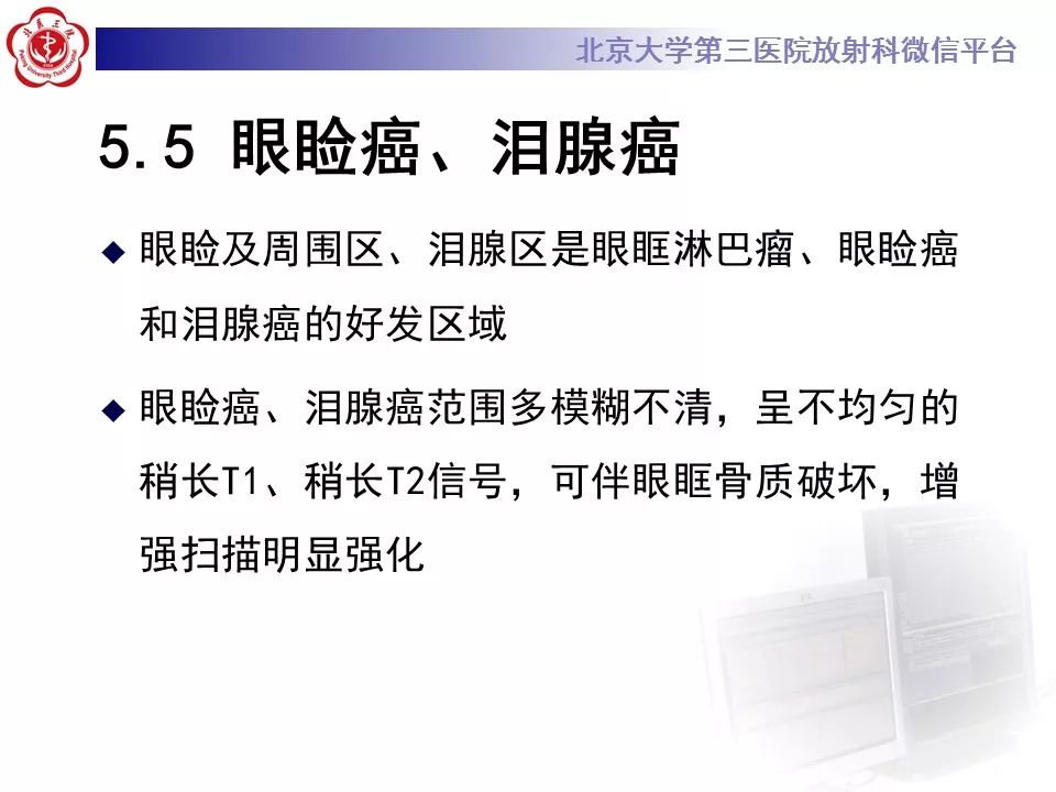 【病例】眼眶淋巴瘤1例CT影像表现