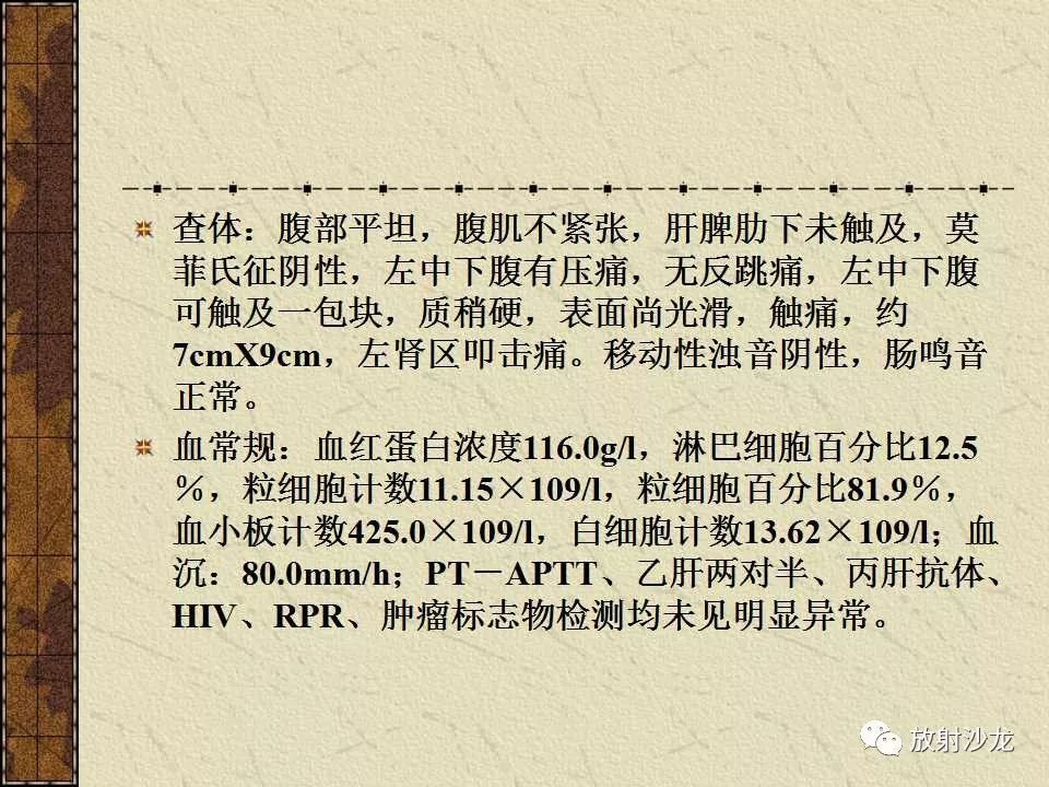 【病例】胃肠道外恶性间质瘤1例CT