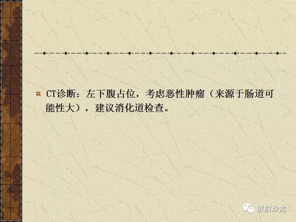 【病例】胃肠道外恶性间质瘤1例CT