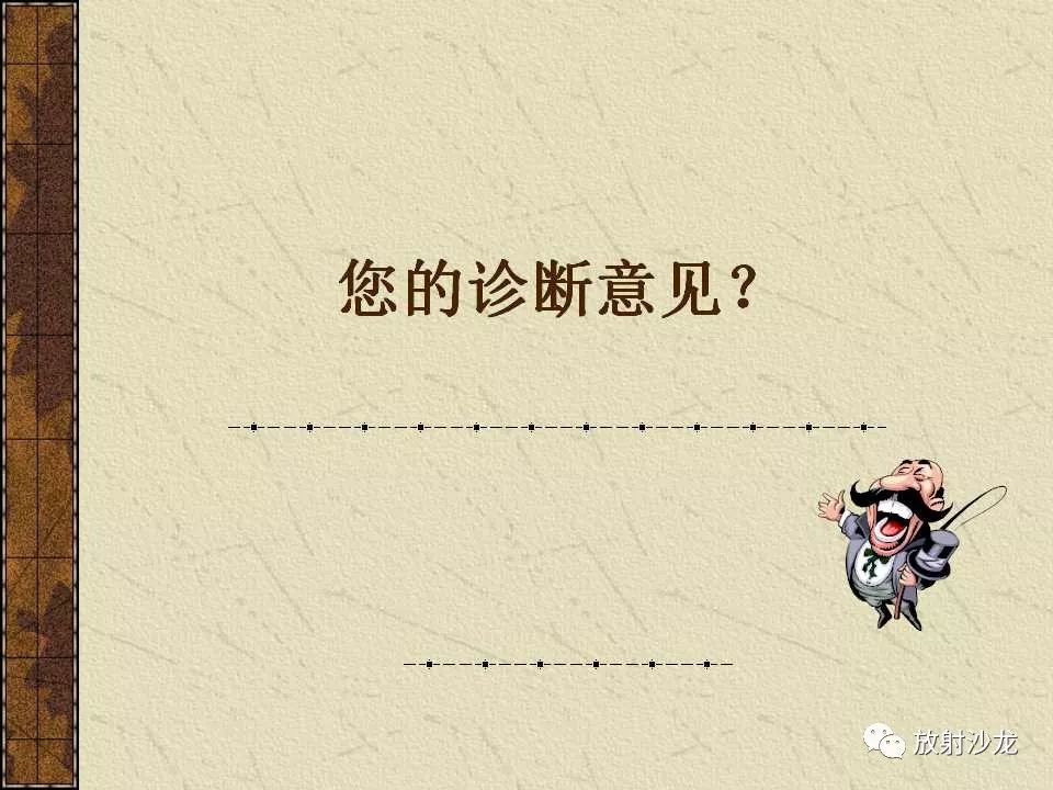 【病例】胃肠道外恶性间质瘤1例CT