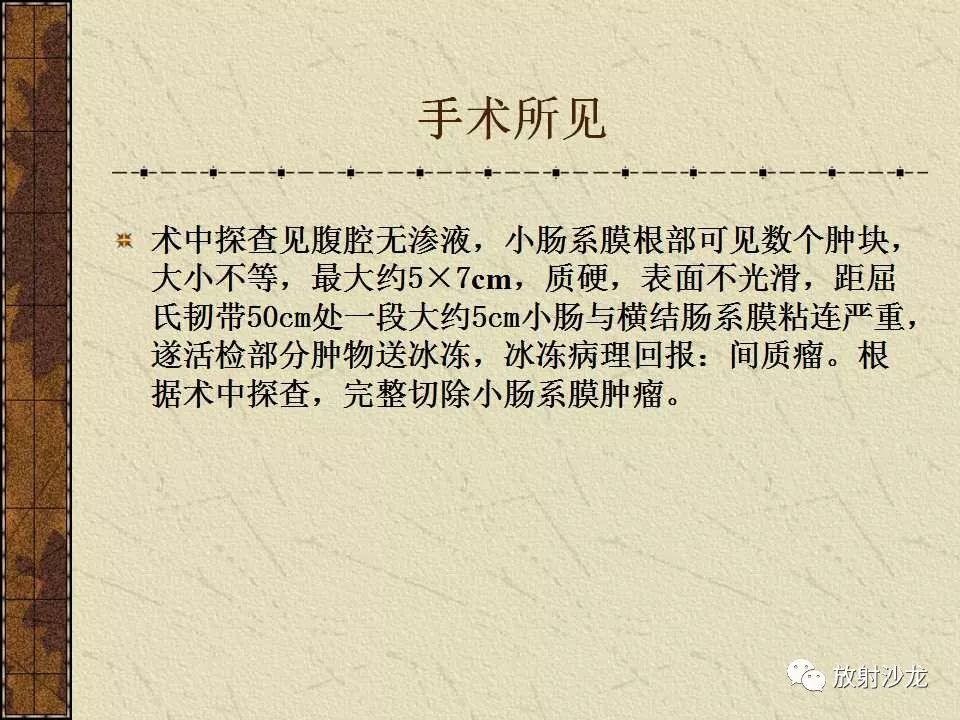 【病例】胃肠道外恶性间质瘤1例CT