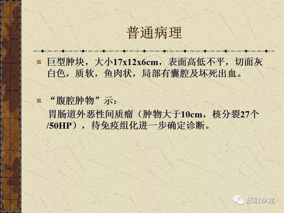 【病例】胃肠道外恶性间质瘤1例CT