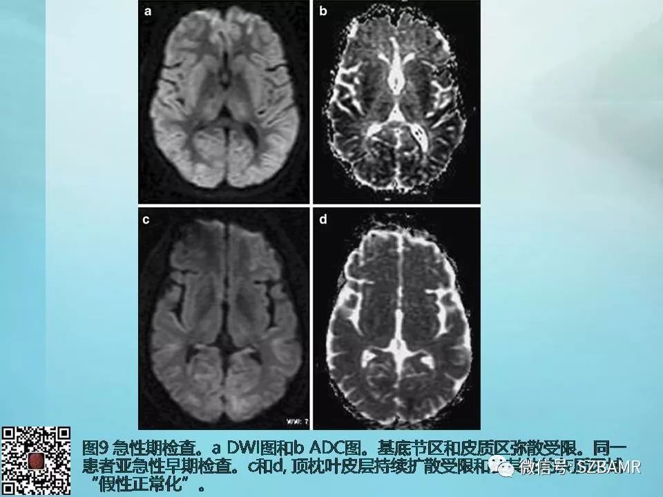 【PPT】非新生儿缺氧缺血性脑病的病理生理学改变及CT和MRI表现