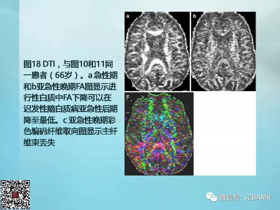 【PPT】非新生儿缺氧缺血性脑病的病理生理学改变及CT和MRI表现