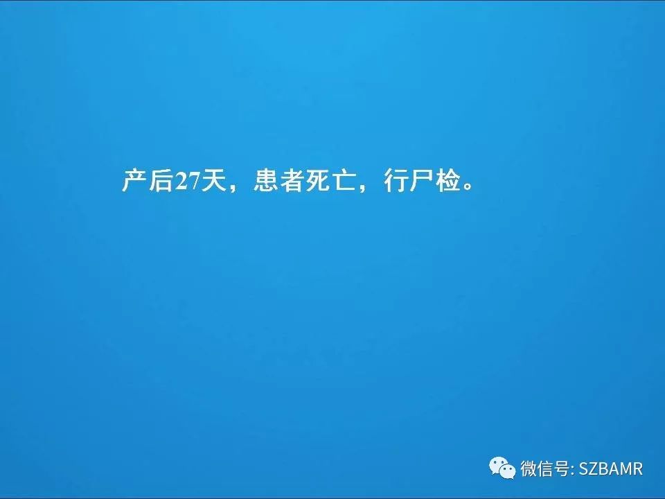 【PPT】一例可逆性脑血管收缩综合症(RCVS)诊治中的思考