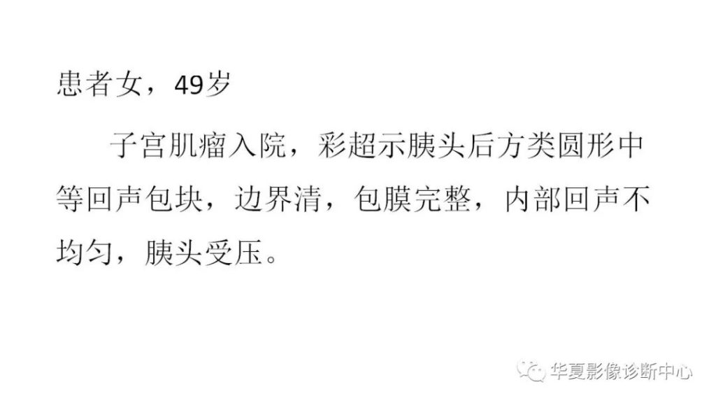【病例】胰头神经内分泌肿瘤1例CT影像表现