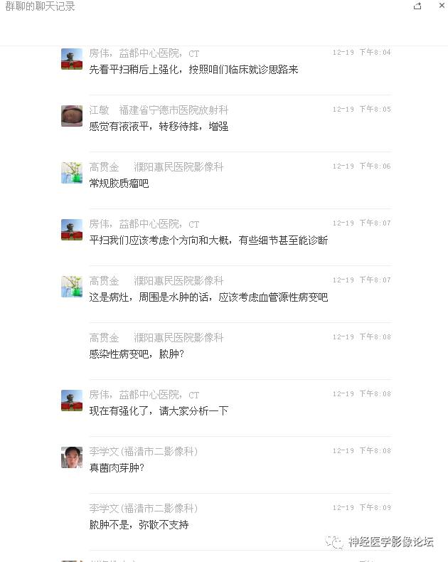 【病例】右额叶脑挫裂伤一例MR及CT
