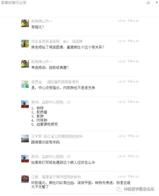 【病例】右额叶脑挫裂伤一例MR及CT