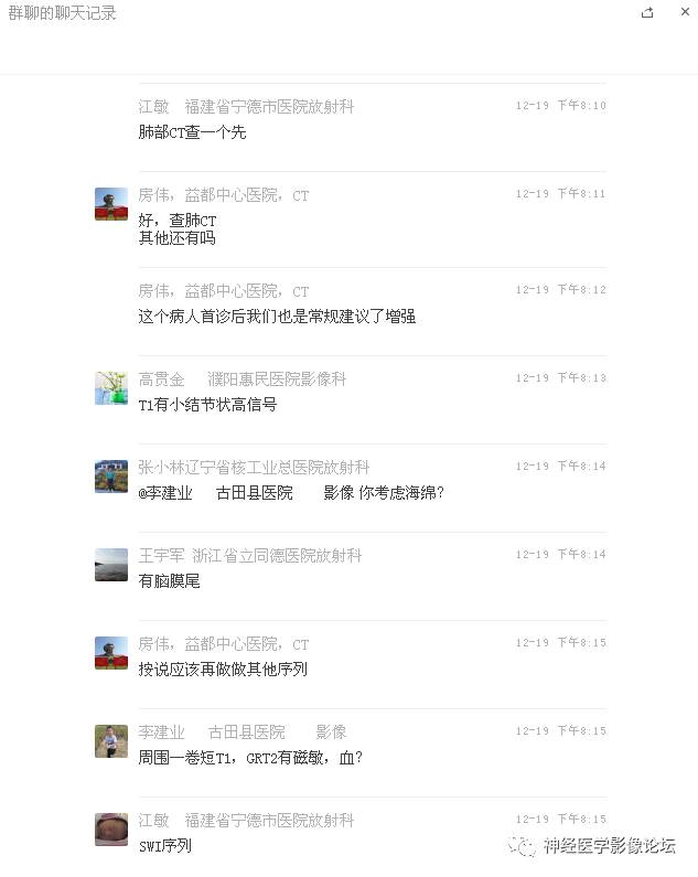 【病例】右额叶脑挫裂伤一例MR及CT