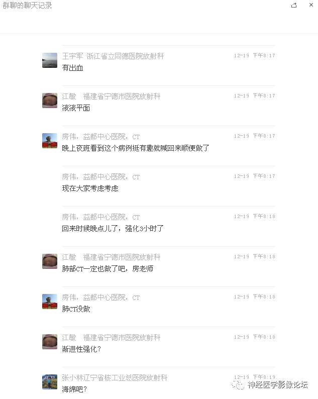 【病例】右额叶脑挫裂伤一例MR及CT