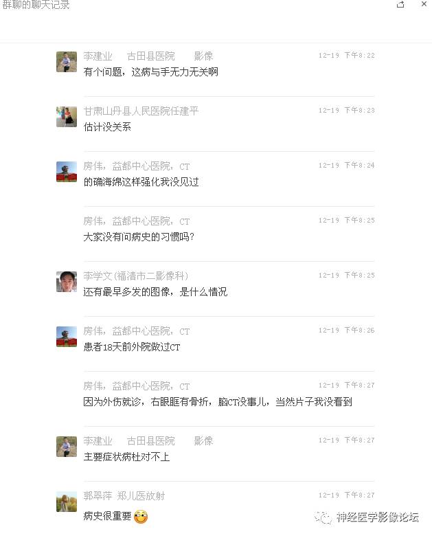 【病例】右额叶脑挫裂伤一例MR及CT
