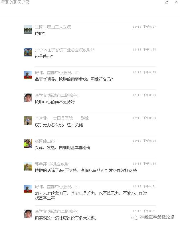 【病例】右额叶脑挫裂伤一例MR及CT