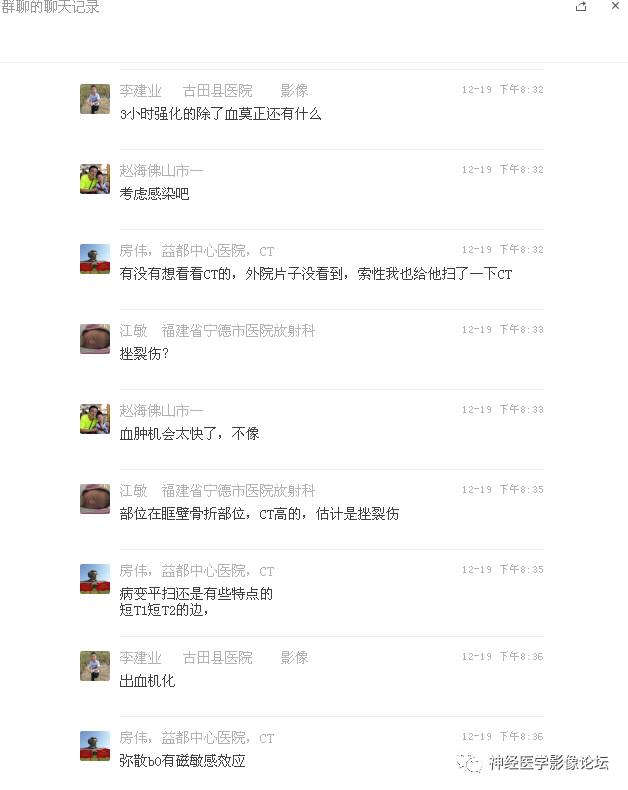 【病例】右额叶脑挫裂伤一例MR及CT
