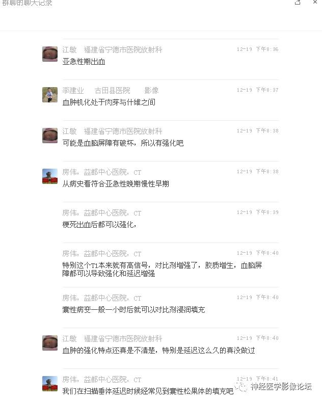 【病例】右额叶脑挫裂伤一例MR及CT