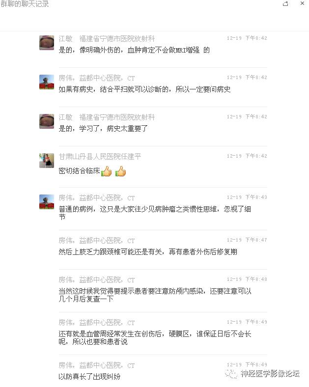 【病例】右额叶脑挫裂伤一例MR及CT