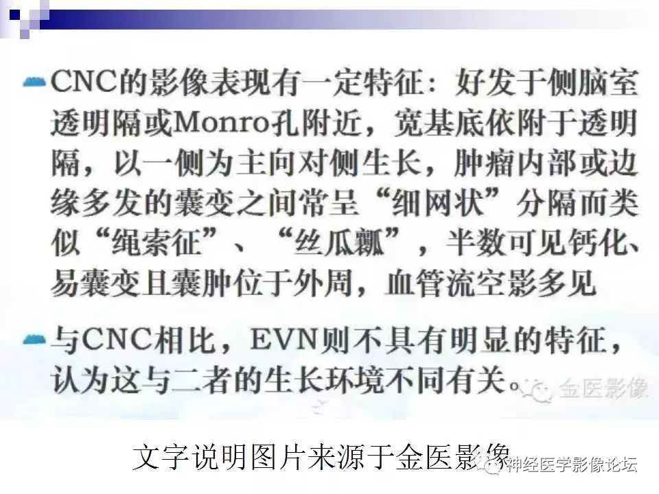 【病例】脑室外中枢神经细胞瘤1例MR
