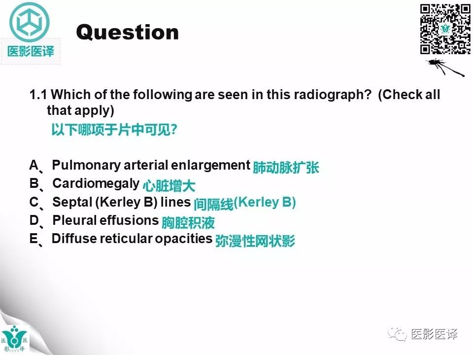 【病例】肺毛细血管瘤病1例CT影像表现