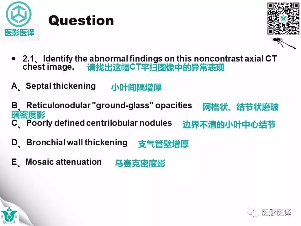 【病例】肺毛细血管瘤病1例CT影像表现