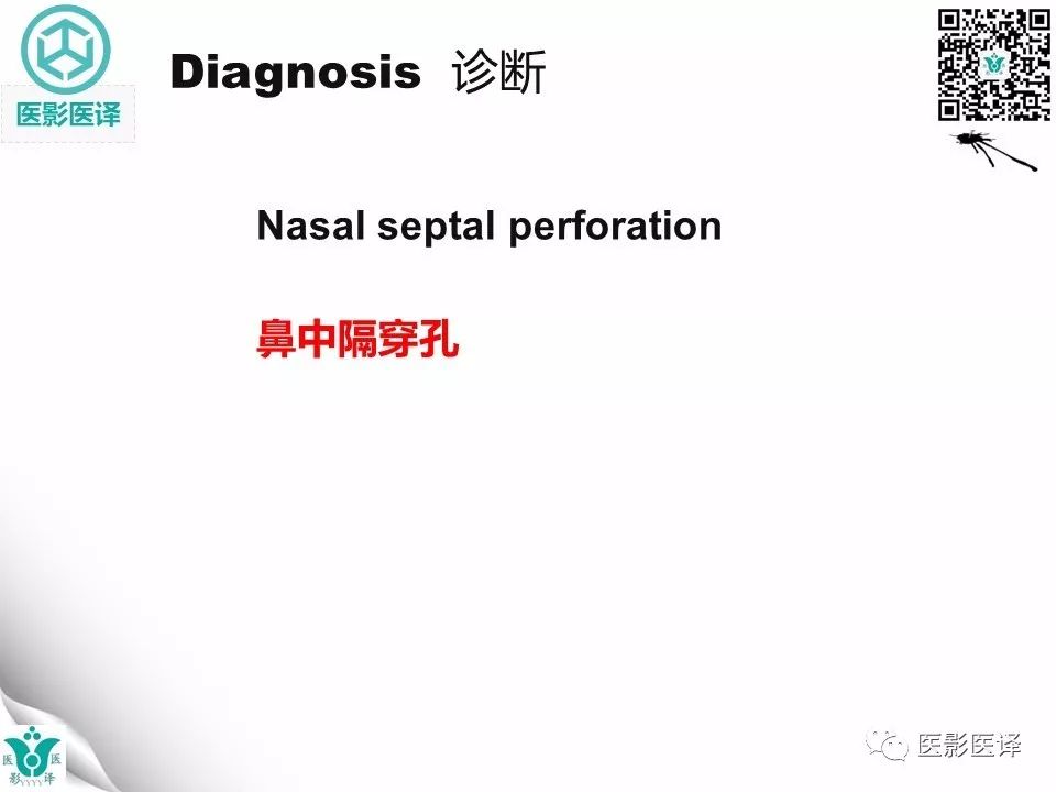【病例】鼻中隔穿孔1例CT影像表现