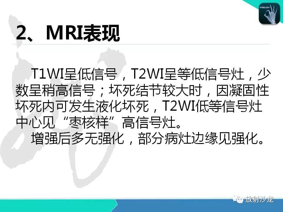 【PPT】肝脏孤立性坏死结节的CT、MRI诊断及鉴别诊断