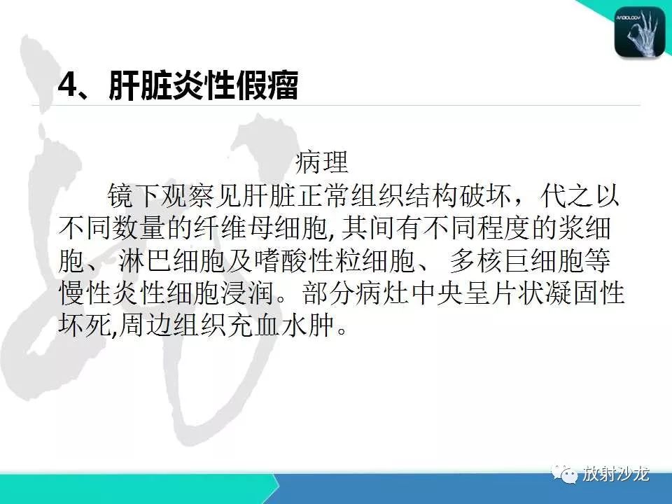 【PPT】肝脏孤立性坏死结节的CT、MRI诊断及鉴别诊断