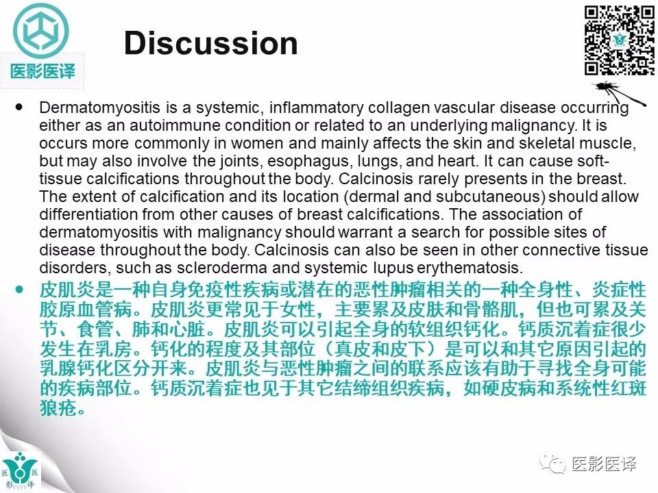 【病例】皮肌炎相关性乳腺钙质沉着症1例X线钼靶影像表现