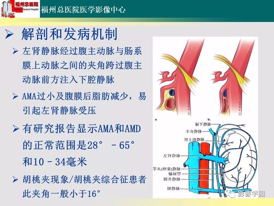 【PPT】256层螺旋CT血管成像技术在腹盆部血管压迫综合征诊断的应用 【PPT】256层螺旋CT血管成像技术在腹盆部血管压迫综合征诊断的应用