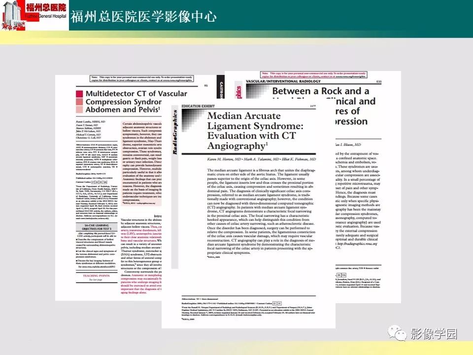【PPT】256层螺旋CT血管成像技术在腹盆部血管压迫综合征诊断的应用 【PPT】256层螺旋CT血管成像技术在腹盆部血管压迫综合征诊断的应用