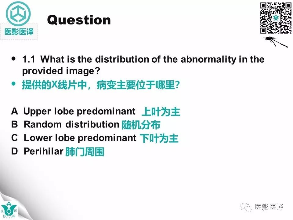 【病例】非特异性间质性肺炎NSIP一例X线CT