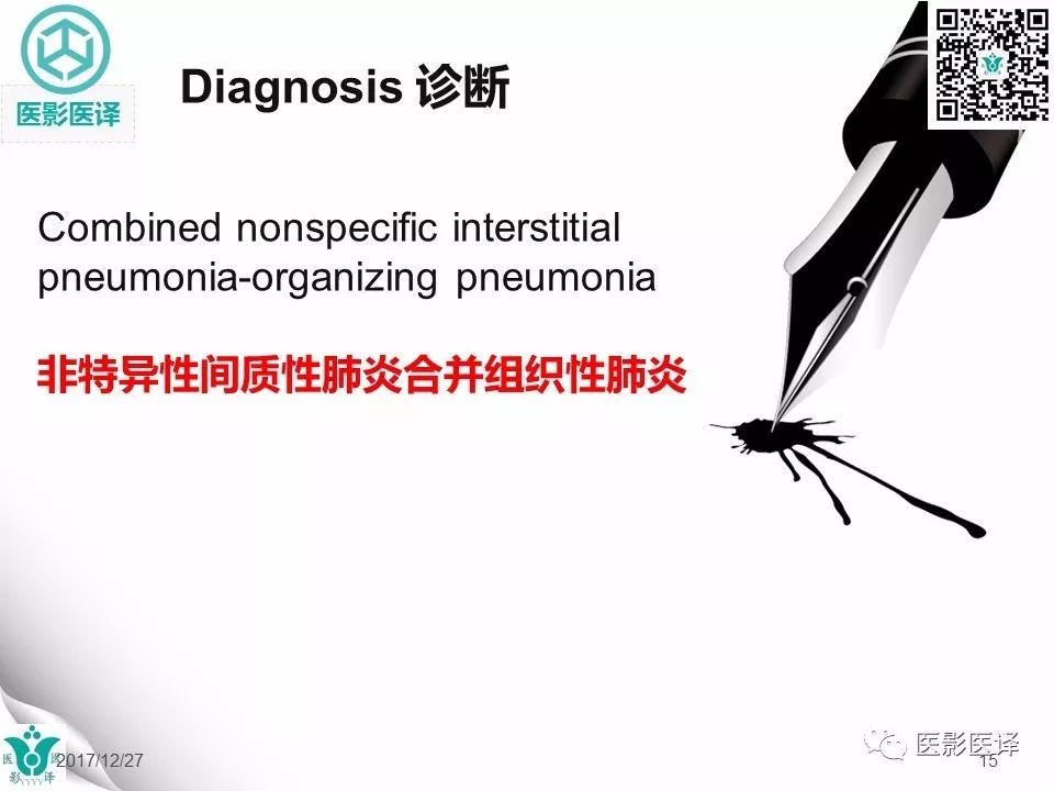 【病例】非特异性间质性肺炎NSIP一例X线CT