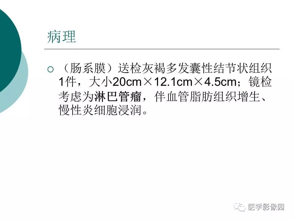 【病例】腹腔淋巴管瘤1例CT影像表现