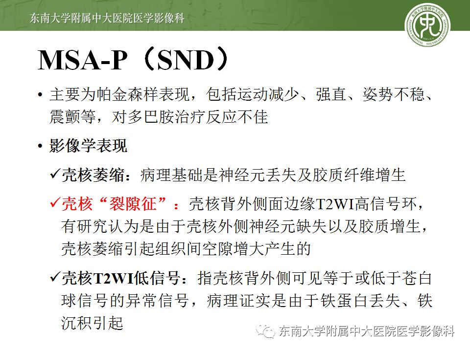 【病例】多系统萎缩1例MR影像诊断