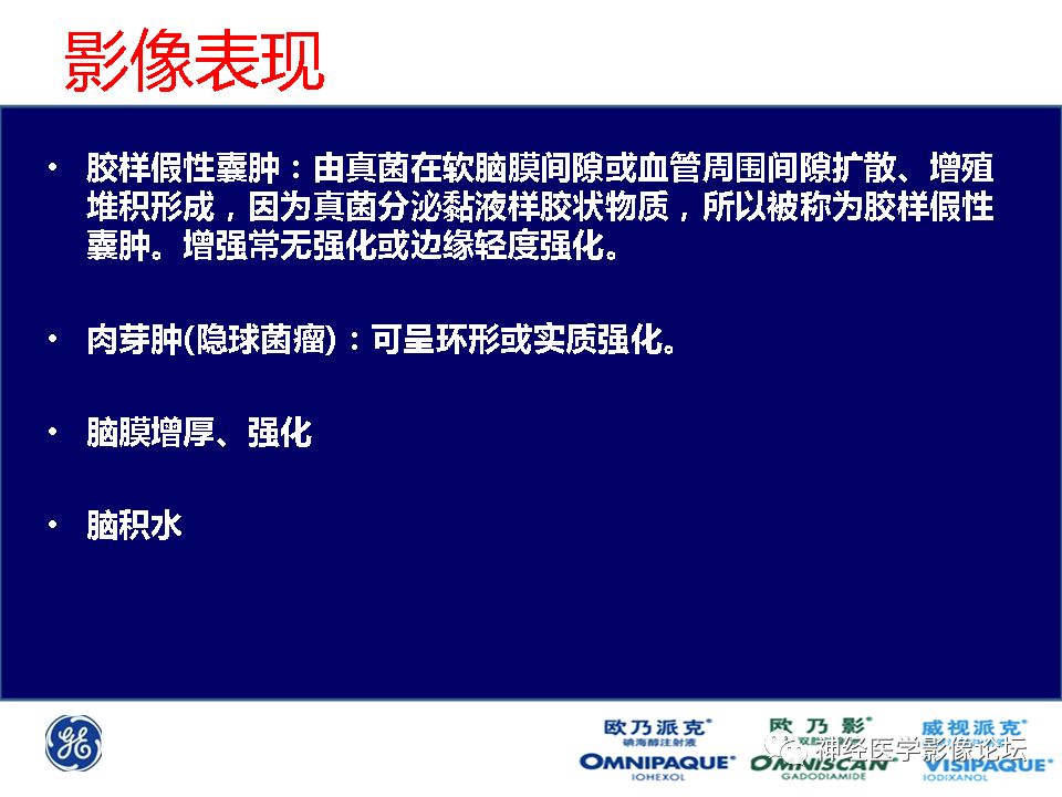 【病例】颅内隐球菌感染一例MR影像表现