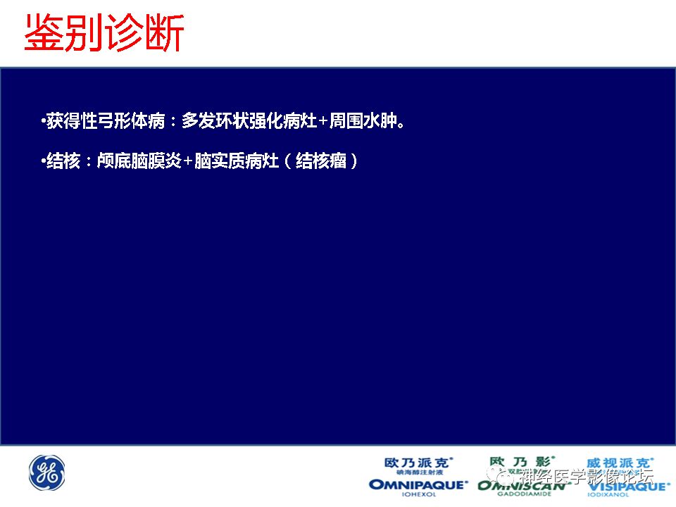 【病例】颅内隐球菌感染一例MR影像表现
