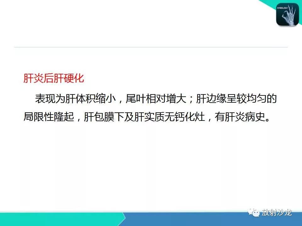 【PPT】肝吸虫性胆管炎的影像诊断