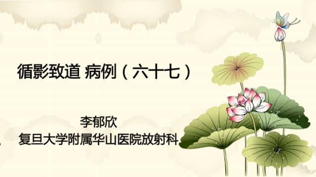 【病例】肾上腺脑白质营养不良1例MR影像诊断分析