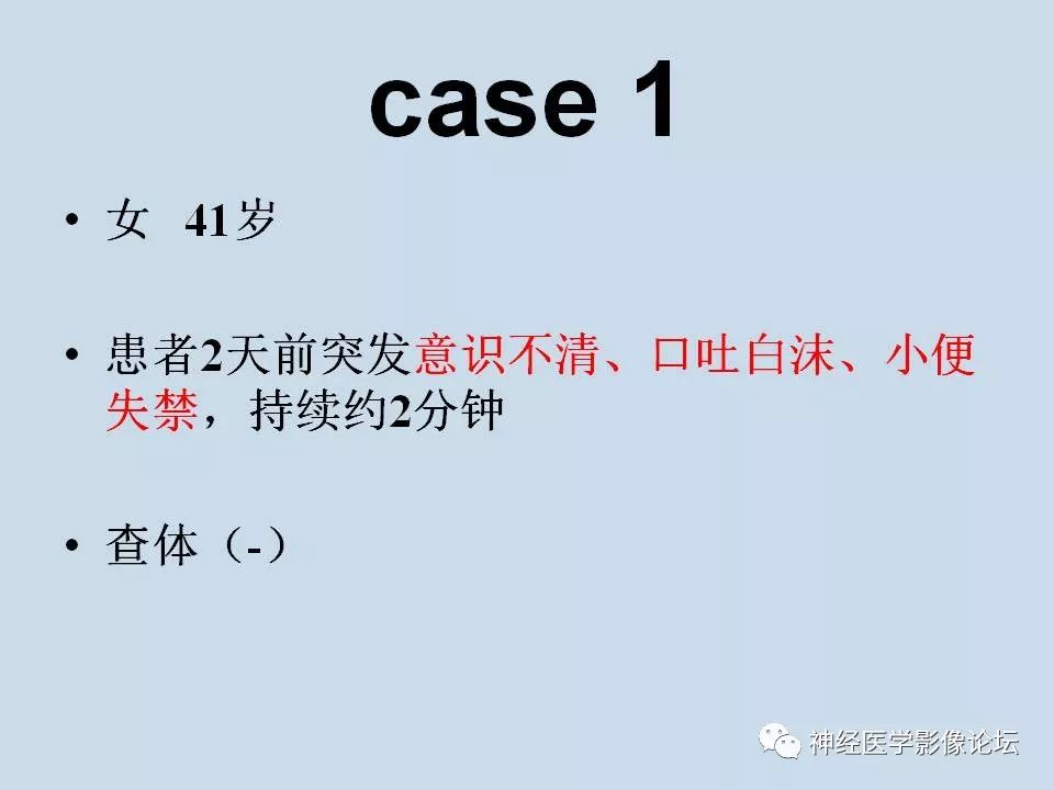 【病例】少突胶质细胞瘤1例MR