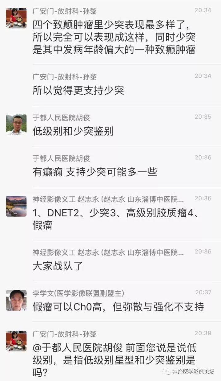 【病例】少突胶质细胞瘤1例MR