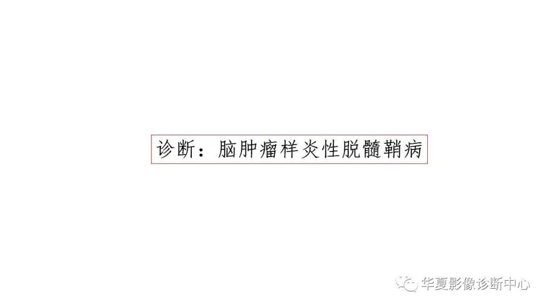 【病例】脑肿瘤样炎性脱髓鞘病1例CT及MR