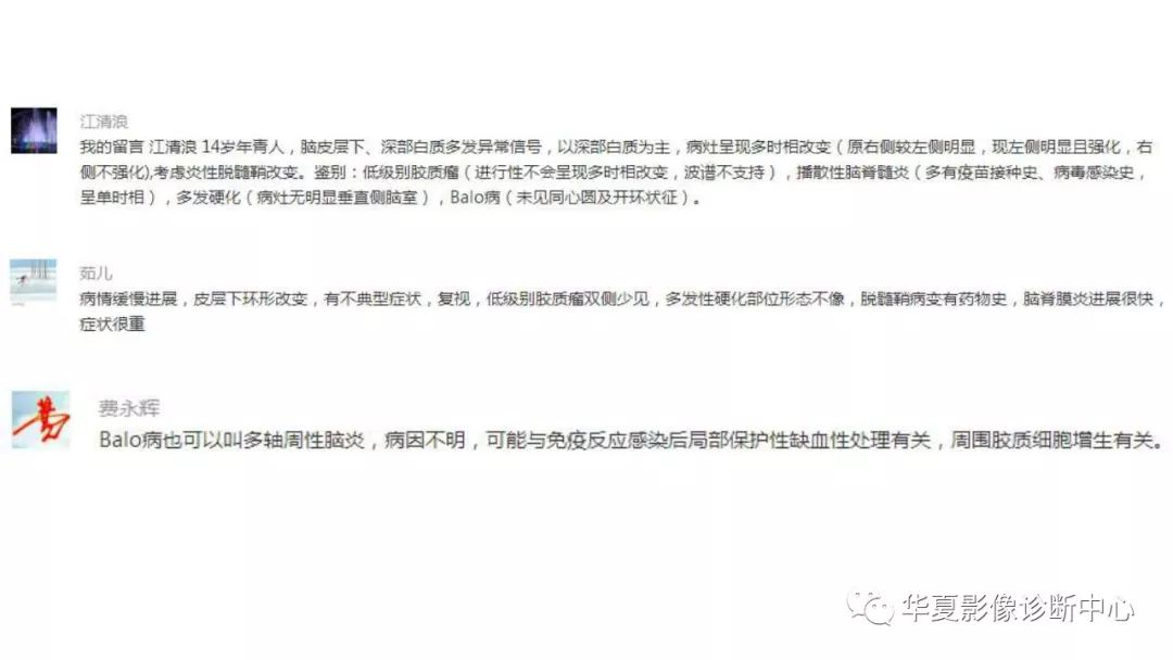 【病例】脑肿瘤样炎性脱髓鞘病1例CT及MR