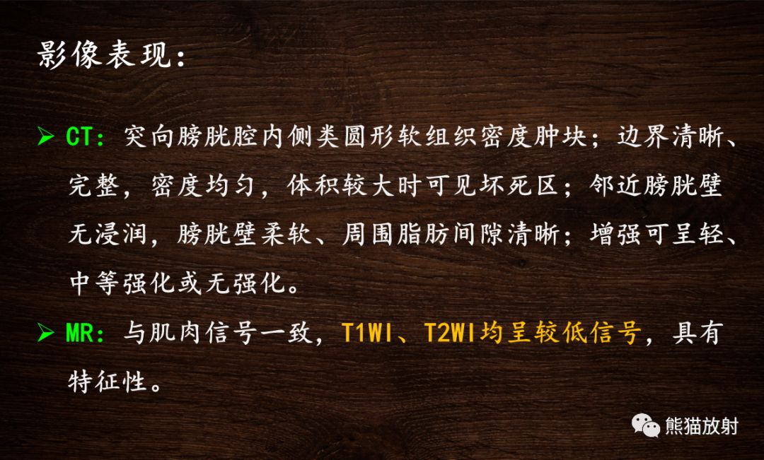【PPT】膀胱疾病的影像学诊断