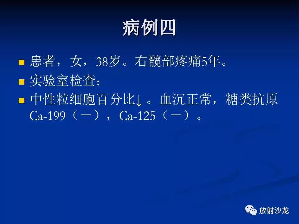 【病例】右侧髂骨软骨粘液性纤维瘤1例X线CT及MR