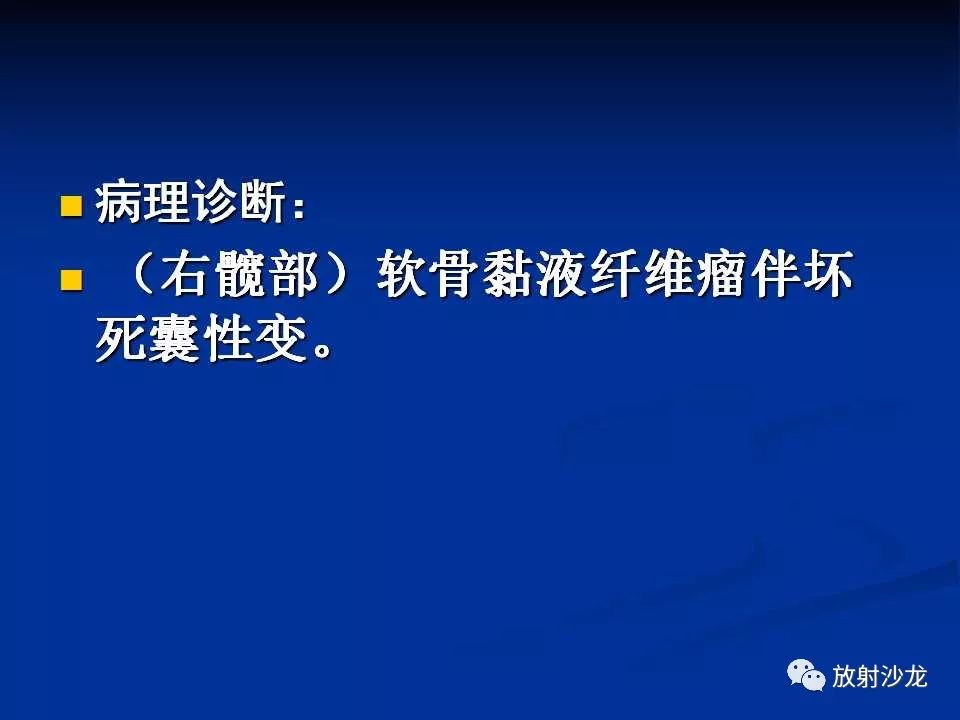 【病例】右侧髂骨软骨粘液性纤维瘤1例X线CT及MR
