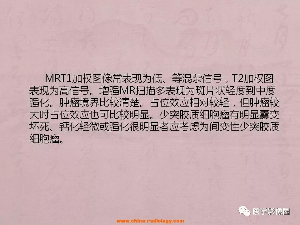 【病例】间变型少突神经胶质细胞瘤1例MR影像表现