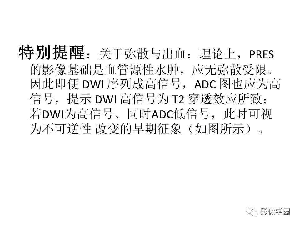 可逆性后部脑病综合征 PRES 可逆性后部脑病综合征 PRES