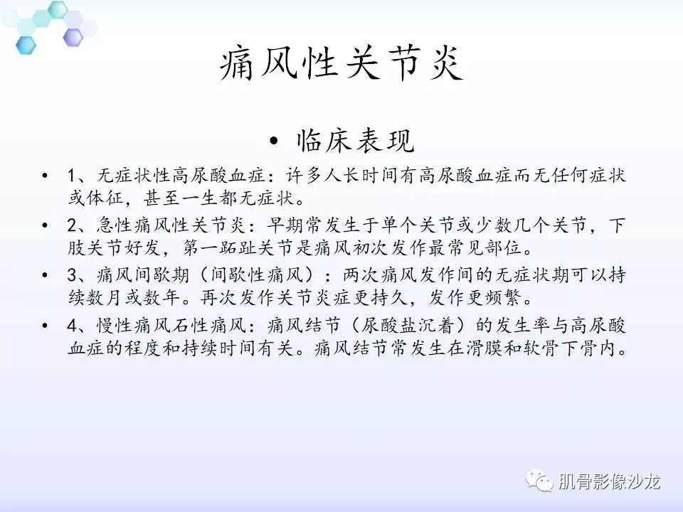 【病例】膝关节痛风性关节炎1例CT 【病例】膝关节痛风性关节炎1例CT