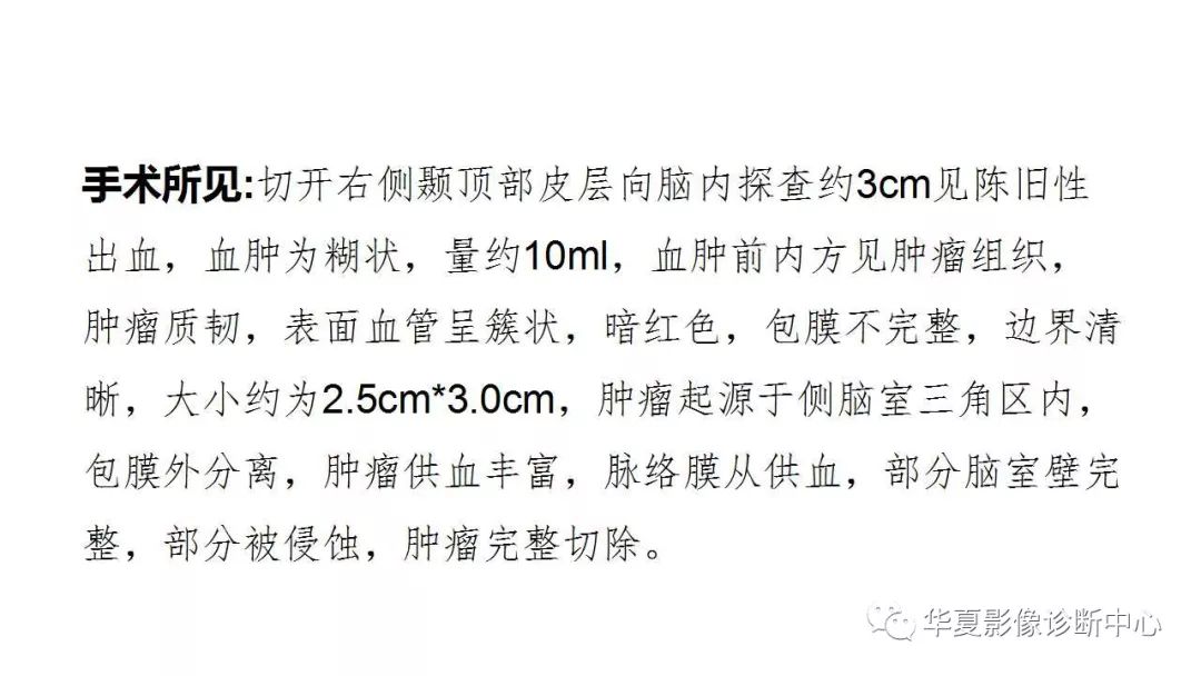 【病例】中枢神经系统淋巴瘤伴出血1例CT及MR