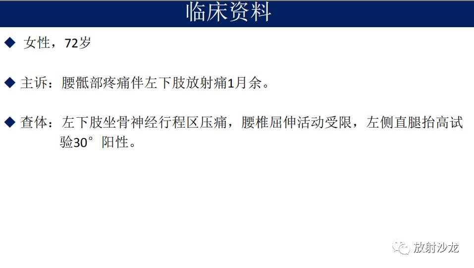 【病例】腹盆腔淋巴瘤1例CT影像表现